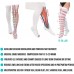 Thigh High Compression Socks, Unisex 15-20 mmHg Moderate Level Anti Embolism Compression Stockings